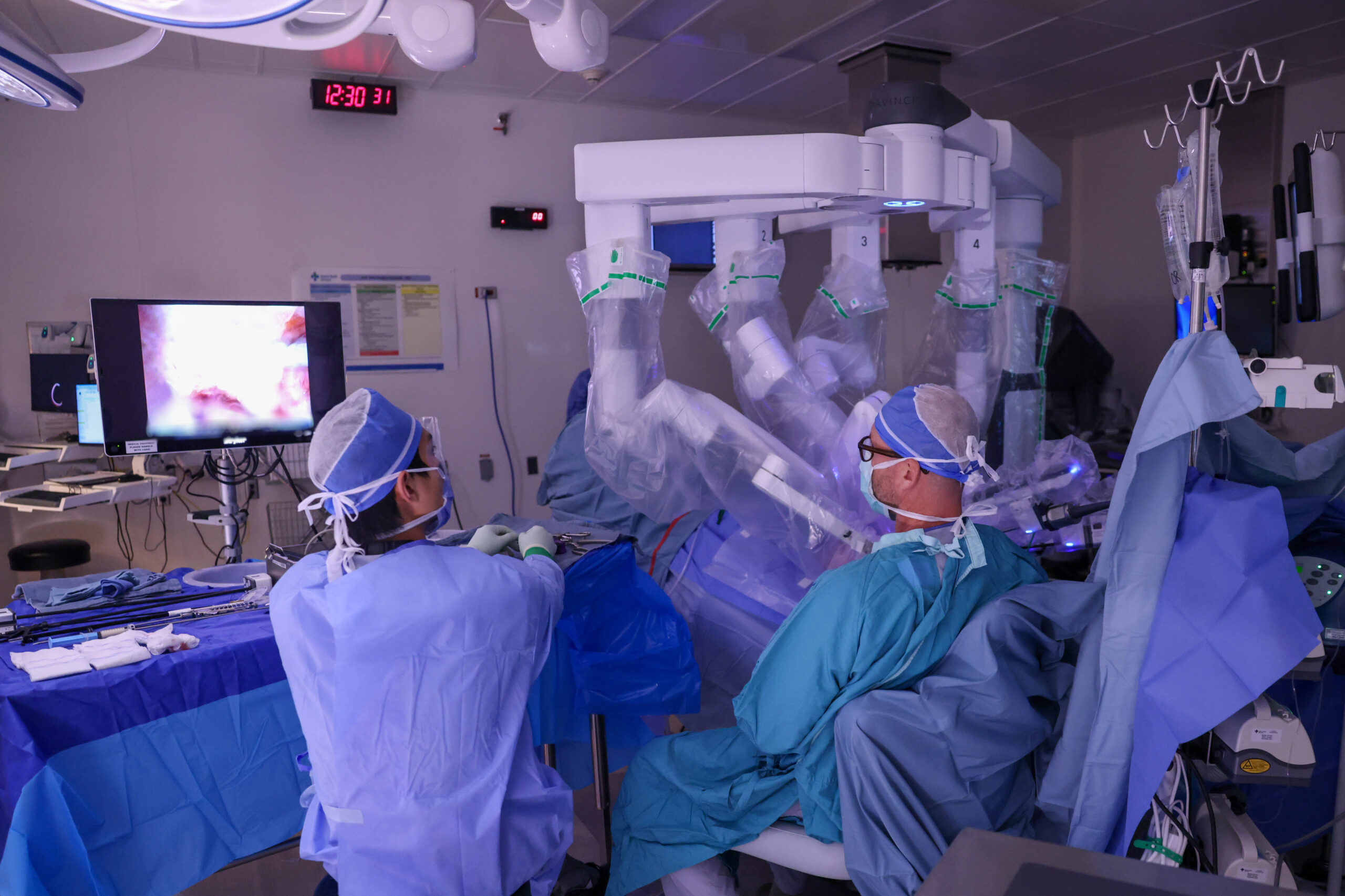 Robotic-assisted Surgery Now Available In Central Alberta Surgeons in blue gowns operate using a robotic surgical system in a sterile operating room with screens in the background.